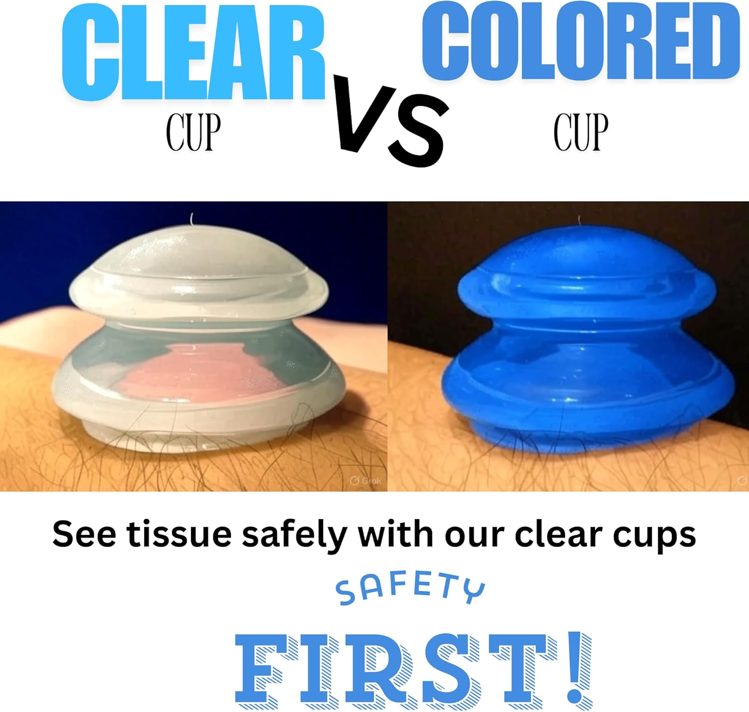 간편 실리콘 부황 Cupping Beginner Silicone Cupping Set 4 Cups