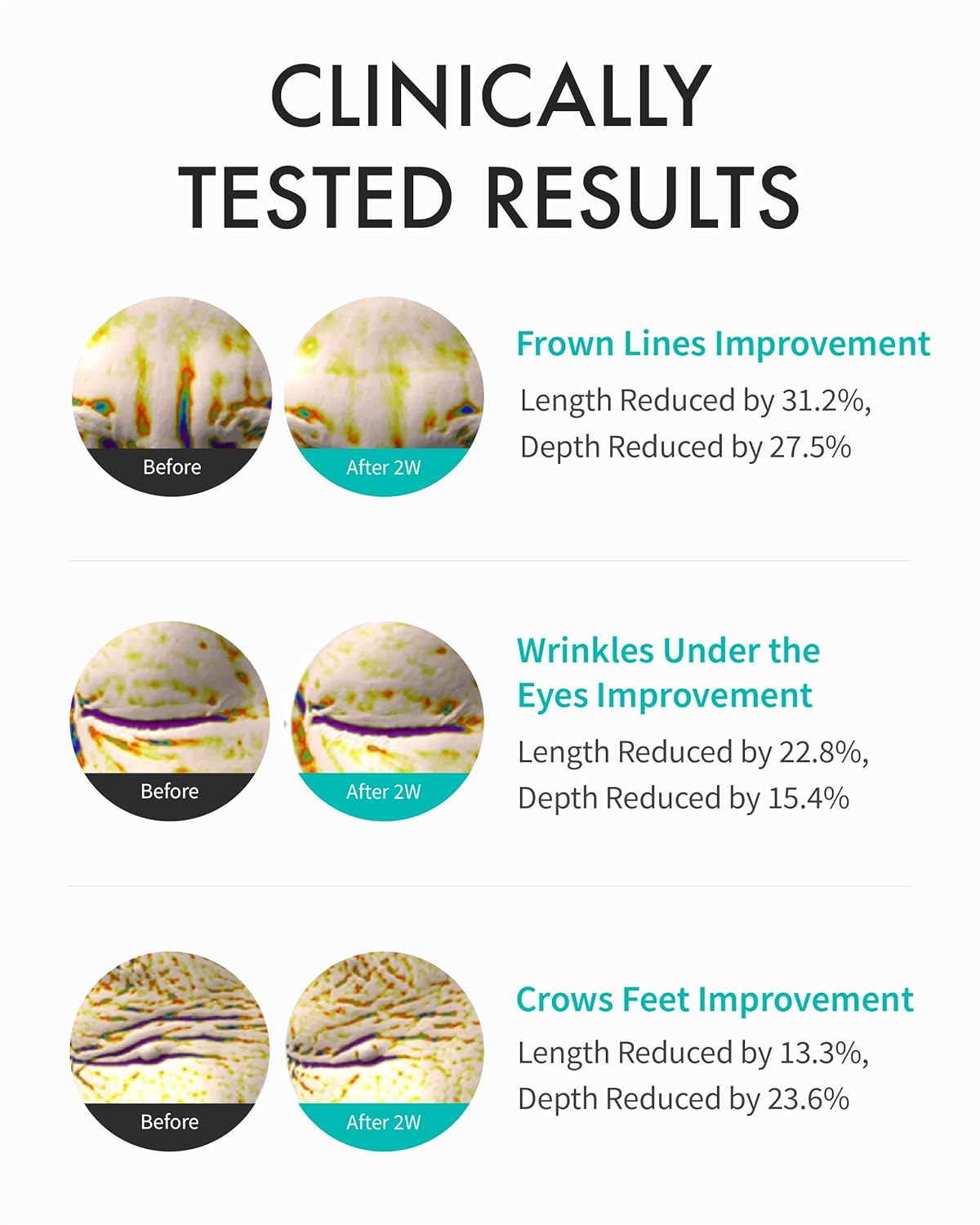 REJURAN® Intensive Eye Cream, C-Pdrn® - Fast-Acting Eye Treatment for Wrinkles, Lifting, and Dark Circles. Instant Hydration and Visible Revitalization. Korean Skin Care (0.67 Fl Oz)