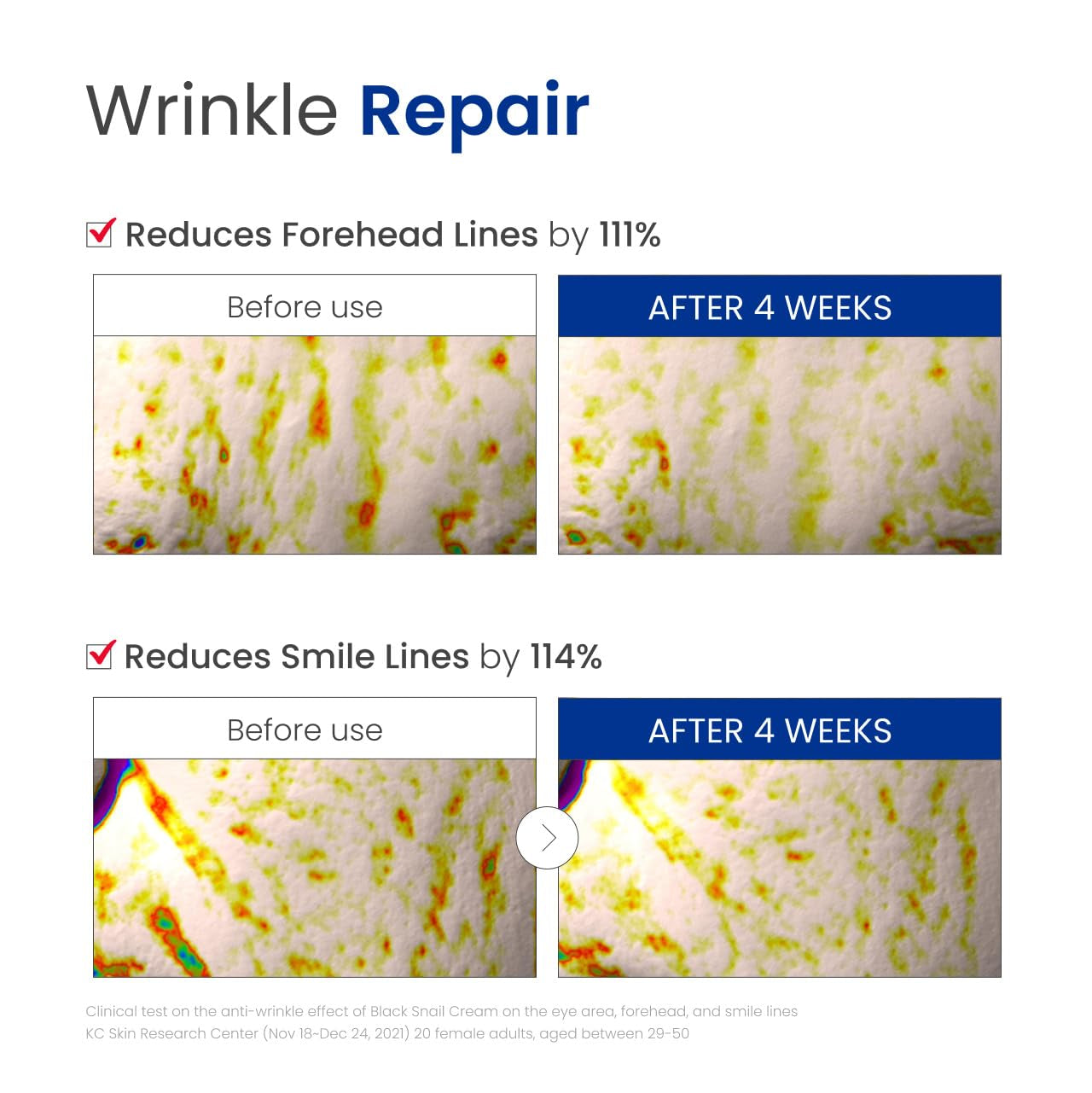 닥터지 블랙 달팽이크림 Dr.G Black Snail Cream