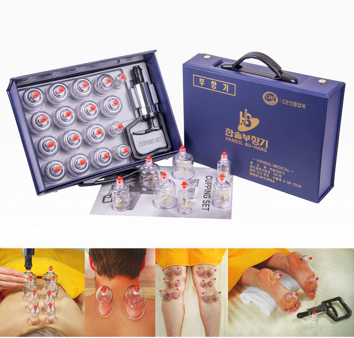 한솔부황 세트 Hansol Cupping Therapy Equipment Set Made in korea