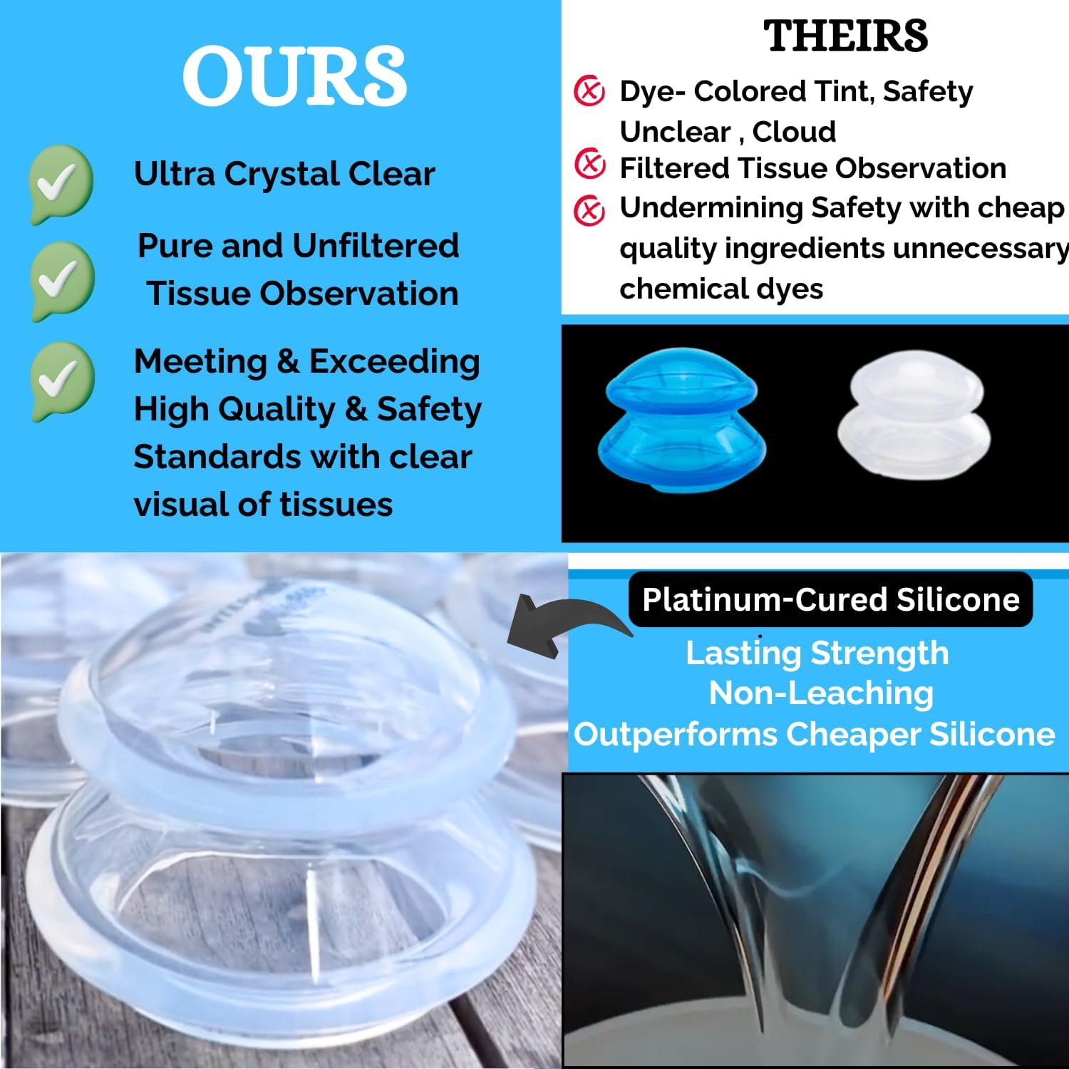 간편 실리콘 부황 Cupping Beginner Silicone Cupping Set 4 Cups 