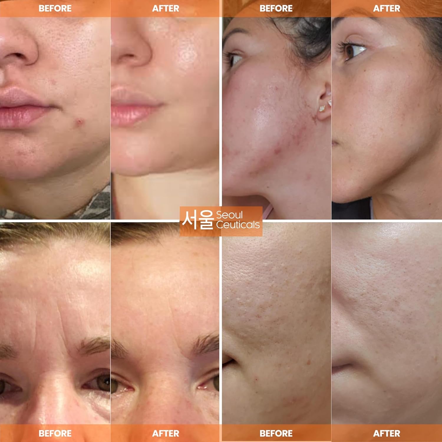 서울 달팽이크림 Seoulceuticals Korean Skin Care 97.5% Snail Mucin Moisturizer Cream 