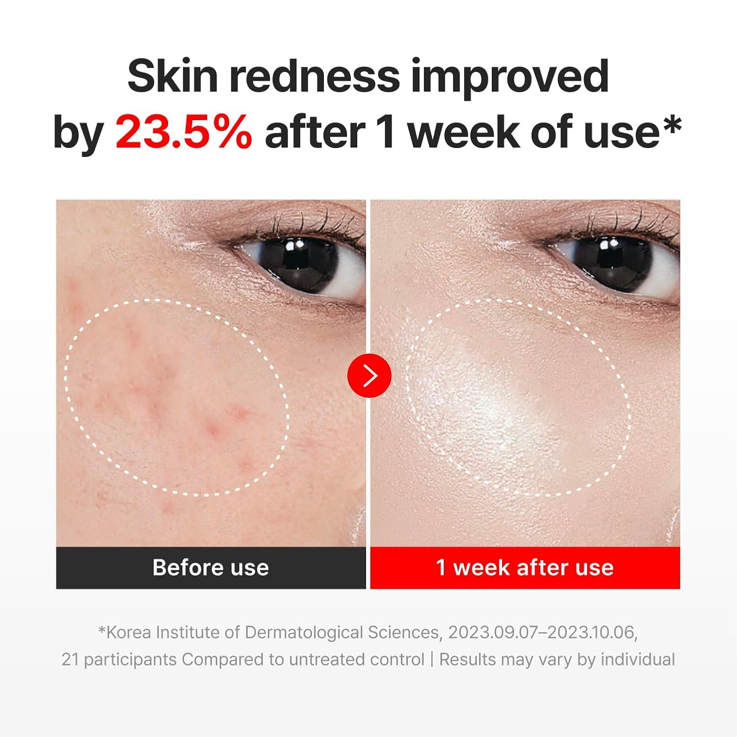 CENTELLIAN 24 마데카크림 타임리버스 병풀추출 TECA / Madeca Cream Time Reverse 1.69 Fl Oz