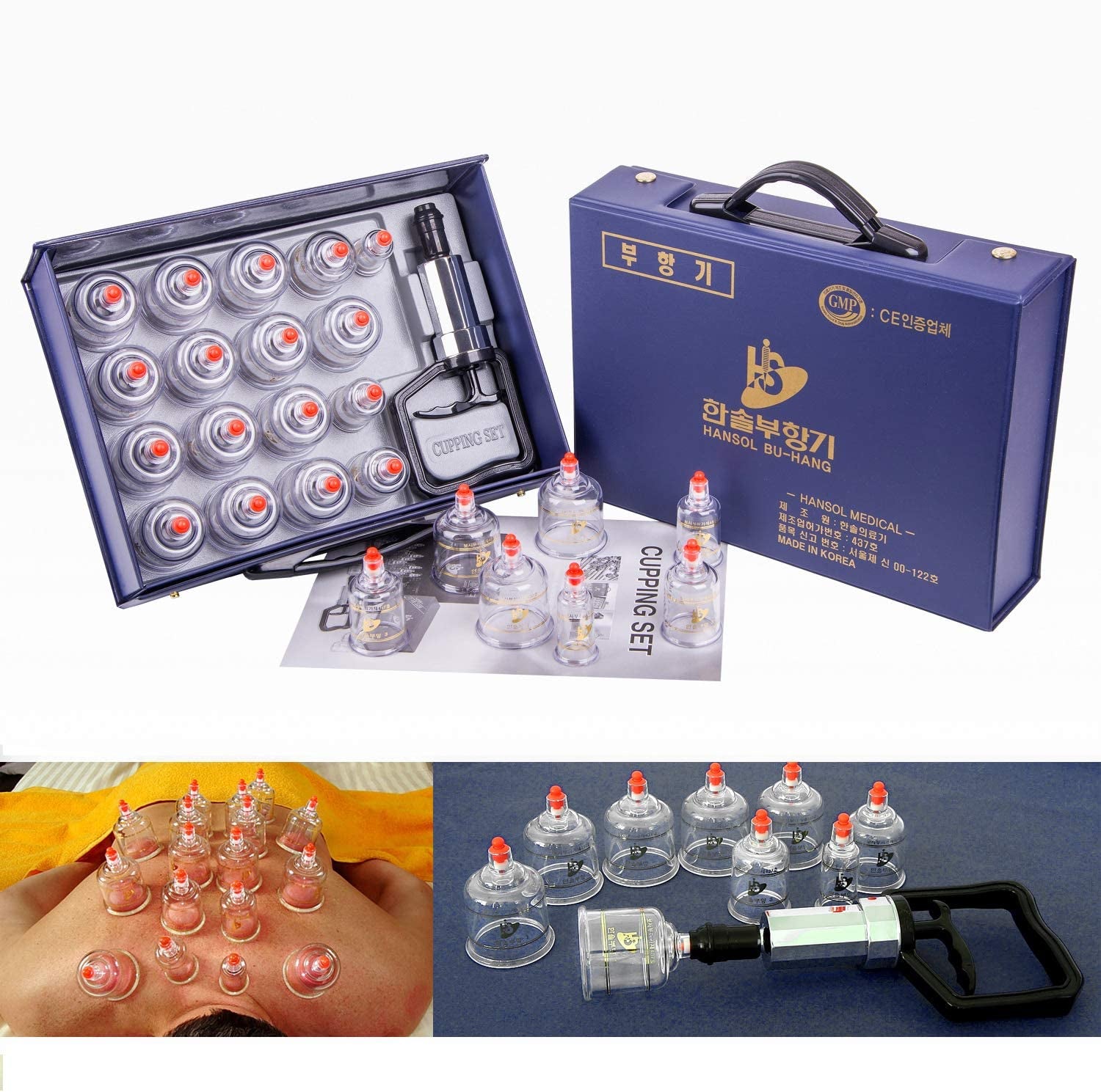 한솔부황 세트 Hansol Cupping Therapy Equipment Set Made in korea